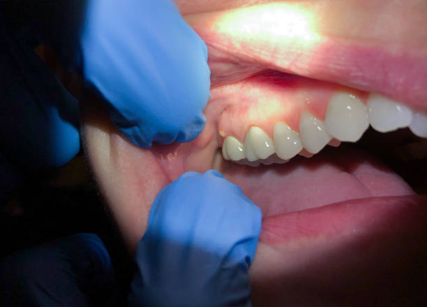 Professional Emergency Dental Service in OR